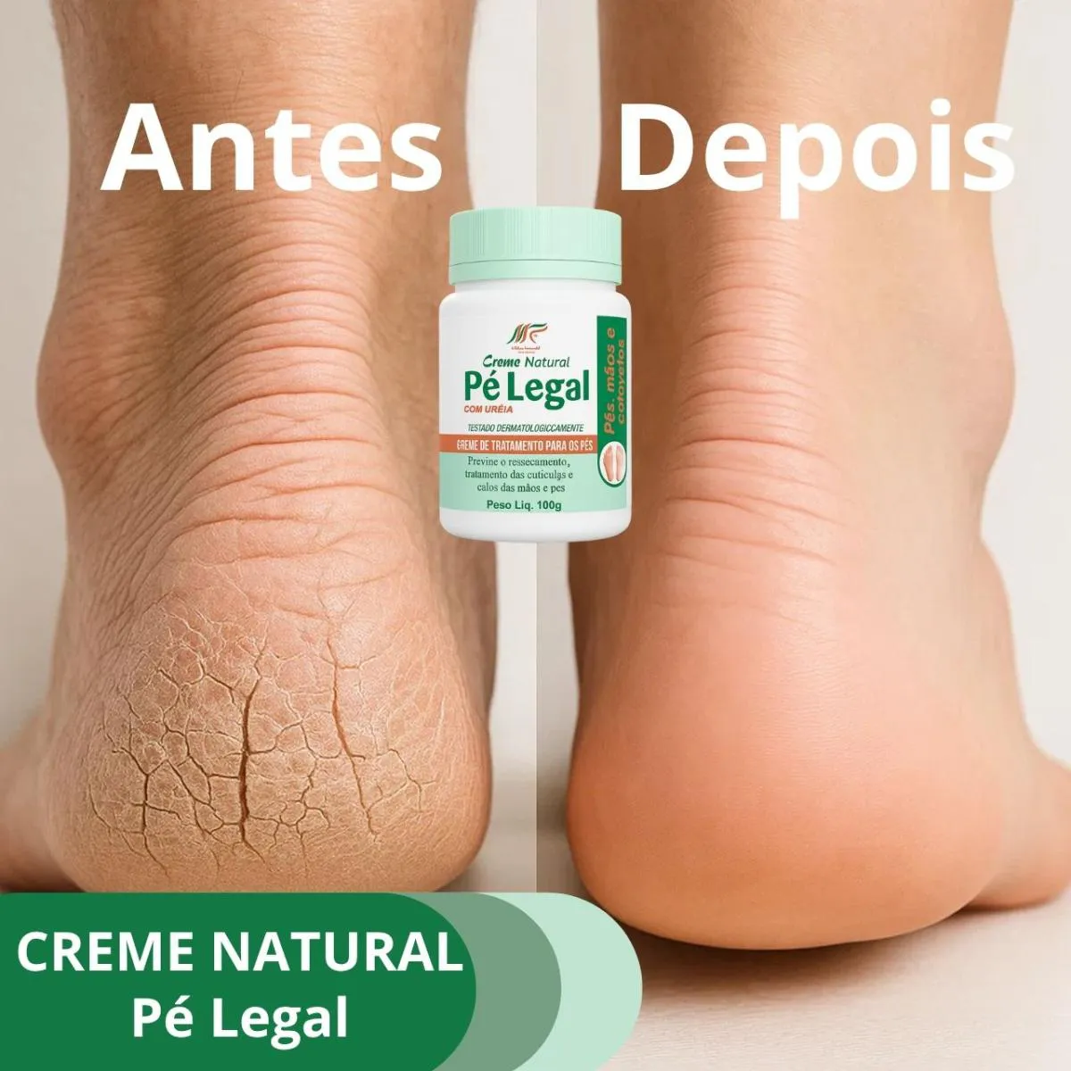 Creme de Uréia para Pés e Cotovelos Hidratação Intensa